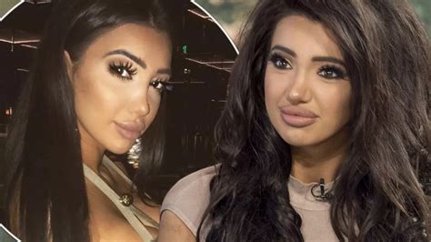 chloe khan plastic surgery